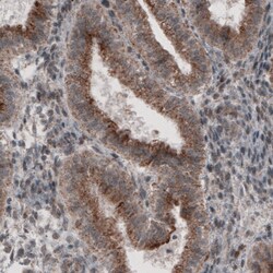 Invitrogen ACAA1 Monoclonal Antibody (CL2662) 100 &mu;L; Unconjugated:Antibodies,