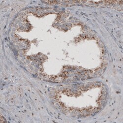 Invitrogen ACAA1 Monoclonal Antibody (CL2662) 100 &mu;L; Unconjugated:Antibodies,