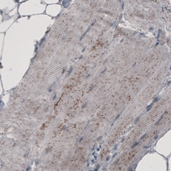 Invitrogen ACAA1 Monoclonal Antibody (CL2662) 100 &mu;L; Unconjugated:Antibodies,
