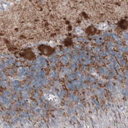 Invitrogen GAD67 Monoclonal Antibody (CL2911) 100 &mu;L; Unconjugated:Antibodies,