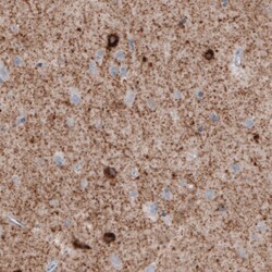 Invitrogen GAD67 Monoclonal Antibody (CL2911) 100 &mu;L; Unconjugated:Antibodies,