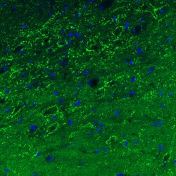 Invitrogen GAD67 Monoclonal Antibody (CL2911) 100 &mu;L; Unconjugated:Antibodies,
