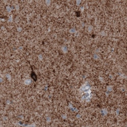 Invitrogen GAD67 Monoclonal Antibody (CL2914) 100 &mu;L; Unconjugated:Antibodies,