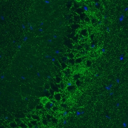 Invitrogen GAD67 Monoclonal Antibody (CL2914) 100 &mu;L; Unconjugated:Antibodies,