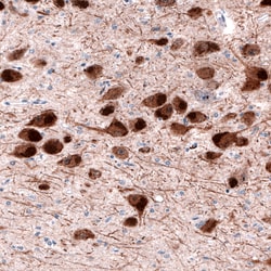Invitrogen DOPA Decarboxylase Monoclonal Antibody (CL2962) 100 &mu;L; Unconjugated:Antibodies,
