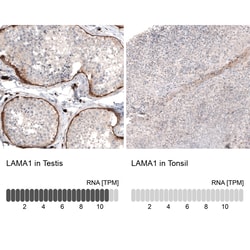 Invitrogen Laminin alpha-1 Monoclonal Antibody (CL2968) 100 &mu;L; Unconjugated:Antibodies
