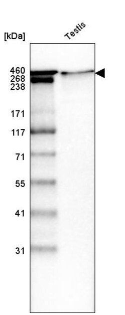 Invitrogen Laminin alpha-1 Monoclonal Antibody (CL2968) 100 &mu;L; Unconjugated:Antibodies