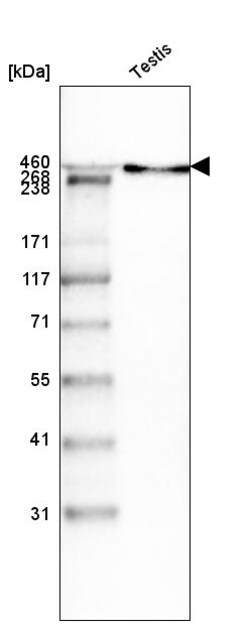 Invitrogen Laminin alpha-1 Monoclonal Antibody (CL3087) 100 &mu;L | Buy Online | Invitrogen&trade; | Fisher Scientific