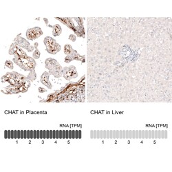 Invitrogen ChAT Monoclonal Antibody (CL3169) 100 &mu;L | Buy Online | Invitrogen&trade; | Fisher Scientific