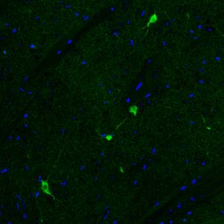 Invitrogen ChAT Monoclonal Antibody (CL3169) 100 &mu;L; Unconjugated:Antibodies,