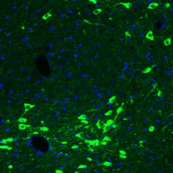 Invitrogen ChAT Monoclonal Antibody (CL3169) 100 &mu;L; Unconjugated:Antibodies,
