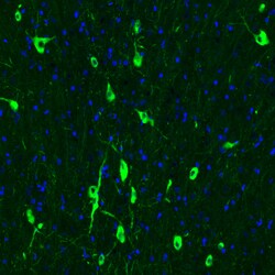 Invitrogen ChAT Monoclonal Antibody (CL3169) 100 &mu;L; Unconjugated:Antibodies,