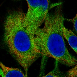 Invitrogen ChAT Monoclonal Antibody (CL3173) 100 &mu;L; Unconjugated:Antibodies,