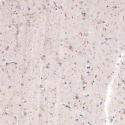 Invitrogen ChAT Monoclonal Antibody (CL3173) 100 &mu;L; Unconjugated:Antibodies,