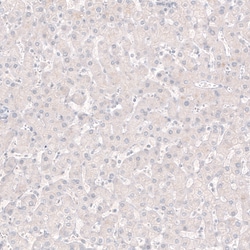 Invitrogen ChAT Monoclonal Antibody (CL3173) 100 &mu;L; Unconjugated:Antibodies,