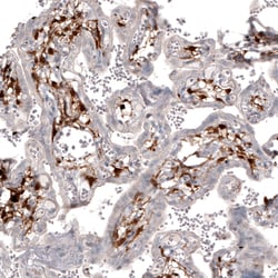 Invitrogen ChAT Monoclonal Antibody (CL3173) 100 &mu;L; Unconjugated:Antibodies,