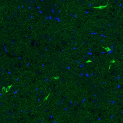 Invitrogen ChAT Monoclonal Antibody (CL3173) 100 &mu;L; Unconjugated:Antibodies,
