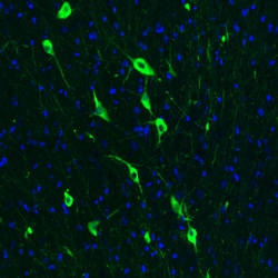 Invitrogen ChAT Monoclonal Antibody (CL3173) 100 &mu;L; Unconjugated:Antibodies,