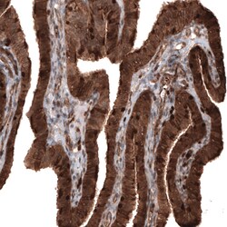 Invitrogen Profilin 1 Monoclonal Antibody (CL3524) 100 &mu;L; Unconjugated:Antibodies,