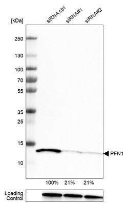 Invitrogen Profilin 1 Monoclonal Antibody (CL3524) 100 &mu;L | Buy Online | Invitrogen&trade; | Fisher Scientific