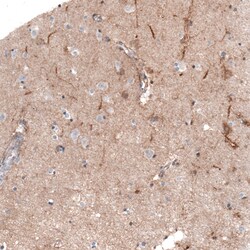 Invitrogen THSD7A Monoclonal Antibody (CL3778) 100 &mu;L; Unconjugated:Antibodies,