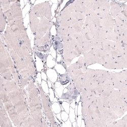 Invitrogen THSD7A Monoclonal Antibody (CL3779) 100 &mu;L; Unconjugated:Antibodies,