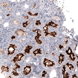 Invitrogen ACE2 Monoclonal Antibody (CL4013) 100 &mu;L; Unconjugated:Antibodies,