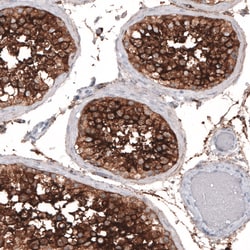 Invitrogen ACE2 Monoclonal Antibody (CL4013) 100 &mu;L; Unconjugated:Antibodies,