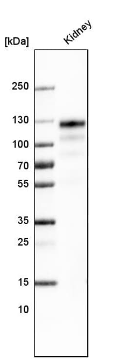 Invitrogen ACE2 Monoclonal Antibody (CL4013) 100 &mu;L | Buy Online | Invitrogen&trade; | Fisher Scientific