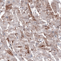 Invitrogen ACE2 Monoclonal Antibody (CL4035) 100 &mu;L; Unconjugated:Antibodies,