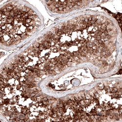 Invitrogen ACE2 Monoclonal Antibody (CL4035) 100 &mu;L; Unconjugated:Antibodies,
