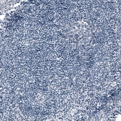 Invitrogen ACE2 Monoclonal Antibody (CL4035) 100 &mu;L; Unconjugated:Antibodies,