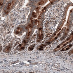 Invitrogen RBCK1 Monoclonal Antibody (CL4289) 100 &mu;L; Unconjugated:Antibodies,