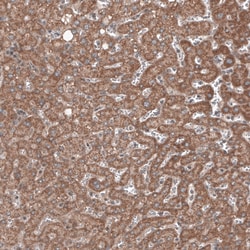 Invitrogen RBCK1 Monoclonal Antibody (CL4289) 100 &mu;L; Unconjugated:Antibodies,
