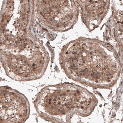 Invitrogen RBCK1 Monoclonal Antibody (CL4289) 100 &mu;L; Unconjugated:Antibodies,