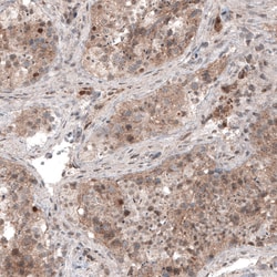 Invitrogen USP30 Monoclonal Antibody (CL4438) 100 &mu;L; Unconjugated:Antibodies,