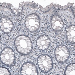 Invitrogen SOX21 Monoclonal Antibody (CL4681) 100 &mu;L; Unconjugated:Antibodies,
