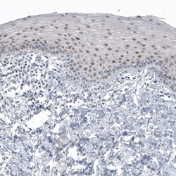 Invitrogen SOX21 Monoclonal Antibody (CL4688) 100 &mu;L; Unconjugated:Antibodies,