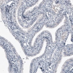Invitrogen SOX21 Monoclonal Antibody (CL4688) 100 &mu;L; Unconjugated:Antibodies,