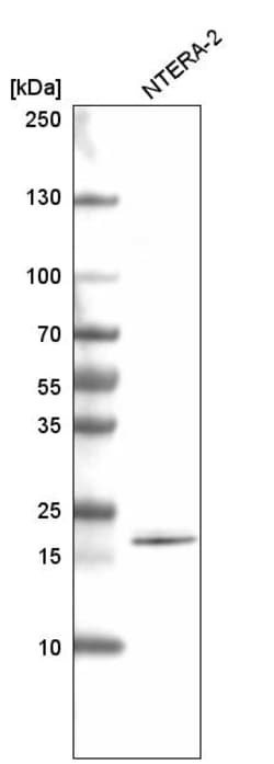 Invitrogen SOX21 Monoclonal Antibody (CL4688) 100 &mu;L; Unconjugated:Antibodies,