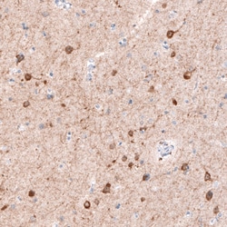 Invitrogen CDKL5 Monoclonal Antibody (CL4888) 100 &mu;L; Unconjugated:Antibodies,