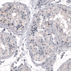 Invitrogen CDKL5 Monoclonal Antibody (CL4888) 100 &mu;L; Unconjugated:Antibodies,