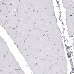 Invitrogen CDKL5 Monoclonal Antibody (CL4888) 100 &mu;L; Unconjugated:Antibodies,