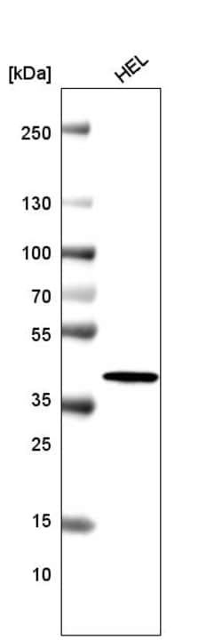 Invitrogen Histone Macro-H2A.1 Monoclonal Antibody (CL5245) 100 &mu;L;