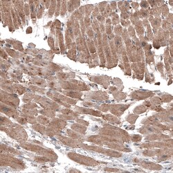 Invitrogen LAPTM4B Monoclonal Antibody (CL5287) 100 &mu;L; Unconjugated:Antibodies,