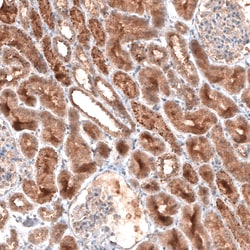 Invitrogen LAPTM4B Monoclonal Antibody (CL5287) 100 &mu;L; Unconjugated:Antibodies,