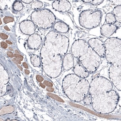 Invitrogen LAPTM4B Monoclonal Antibody (CL5287) 100 &mu;L; Unconjugated:Antibodies,