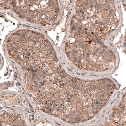 Invitrogen LAPTM4B Monoclonal Antibody (CL5287) 100 &mu;L; Unconjugated:Antibodies,