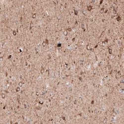 Invitrogen LAPTM4B Monoclonal Antibody (CL5289) 100 &mu;L; Unconjugated:Antibodies,