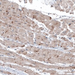 Invitrogen LAPTM4B Monoclonal Antibody (CL5289) 100 &mu;L; Unconjugated:Antibodies,